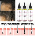 100% ALL NATURAL VEGAN Anti-Itch Growth Scalp Relief Hair Oil 4oz