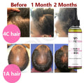 100% ALL NATURAL VEGAN Anti-Itch Growth Scalp Relief Hair Oil 4oz