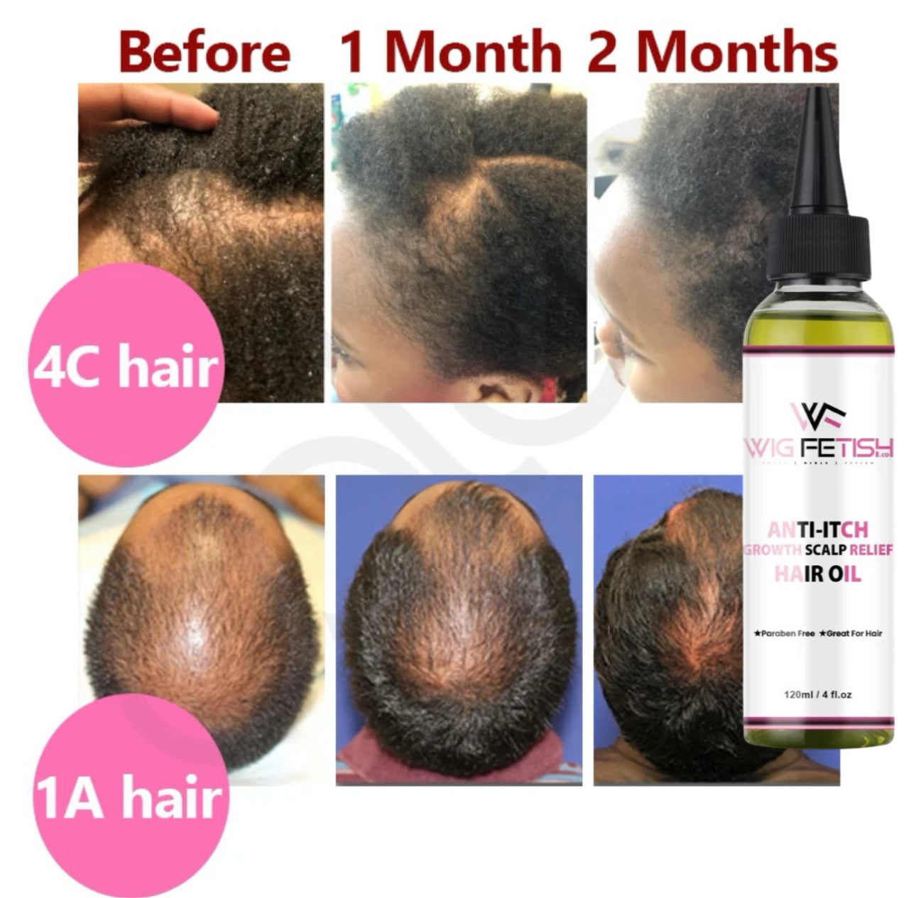 100% ALL NATURAL VEGAN Anti-Itch Growth Scalp Relief Hair Oil 4oz